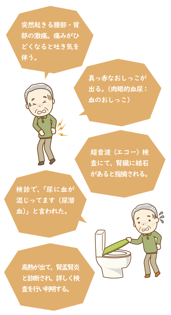 尿路結石症のすべて Amazon.co.jp: ウルトラ図解 尿路結石症 : 松崎 純一: 本