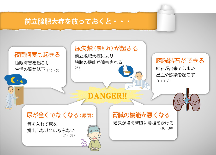前立腺肥大症を放っておくと…　・夜間何度も起きる　睡眠障害を起こし生活の質が低下　・尿失禁(尿モレ)が起きる　前立腺肥大症により膀胱の機能が障害される　・膀胱結石ができる　結石ができてしまい出血や感染を起こす　・尿が全くでなくなる(尿閉)　管を入れて尿を排出しなければならない　・腎臓の機能が悪くなる　残尿が増え腎臓に負担をかける
